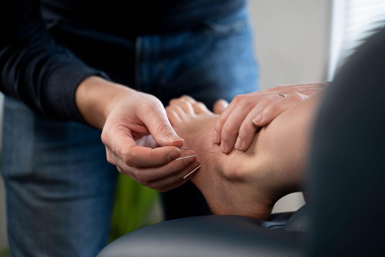 Behandelingen - Dry Needling